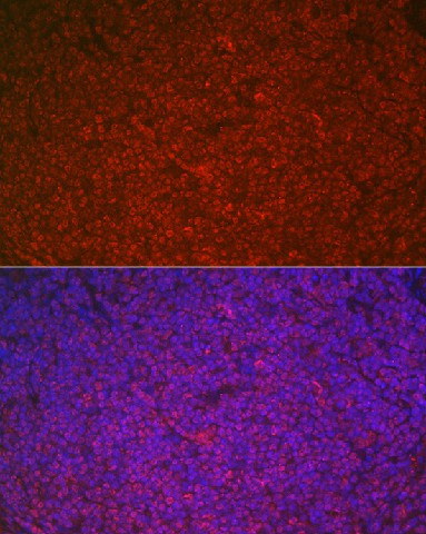 Immunofluorescence analysis of rat spleen cells using ETS1 Polyclonal Antibody at dilution of 1:100 (40x lens). Blue: DAPI for nuclear staining.