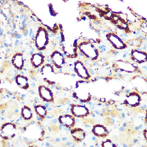 Immunohistochemistry of paraffin-embedded rat kidney using PDE4A Polyclonal Antibody at dilution of 1:100 (40x lens).Perform microwave antigen retrieval with 10 mM Tris/EDTA buffer pH 9.0 before commencing with IHC staining protocol.