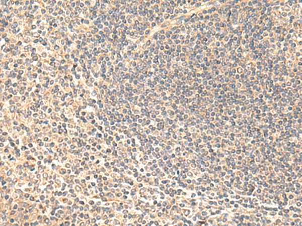 Immunohistochemistry of paraffin-embedded Human tonsil tissue  using SULT4A1 Polyclonal Antibody at dilution of 1:65(?200)