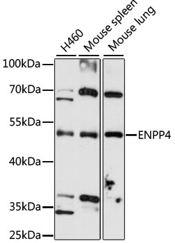 Western blot analysis of extracts of various cell lines using ENPP4 Polyclonal Antibody at 1:3000 dilution.