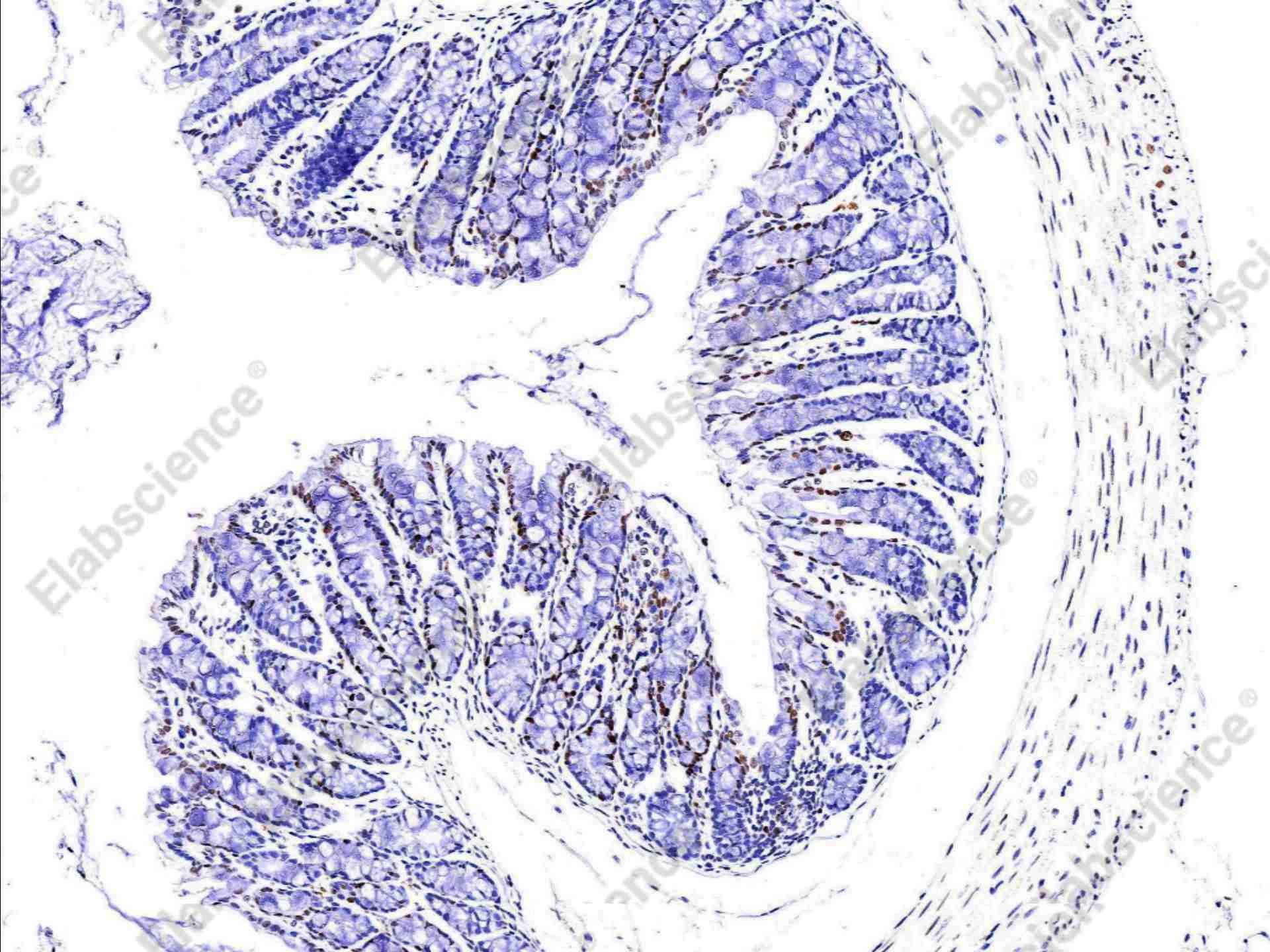 Recombinant MSH6/GTBP Monoclonal Antibody - 2