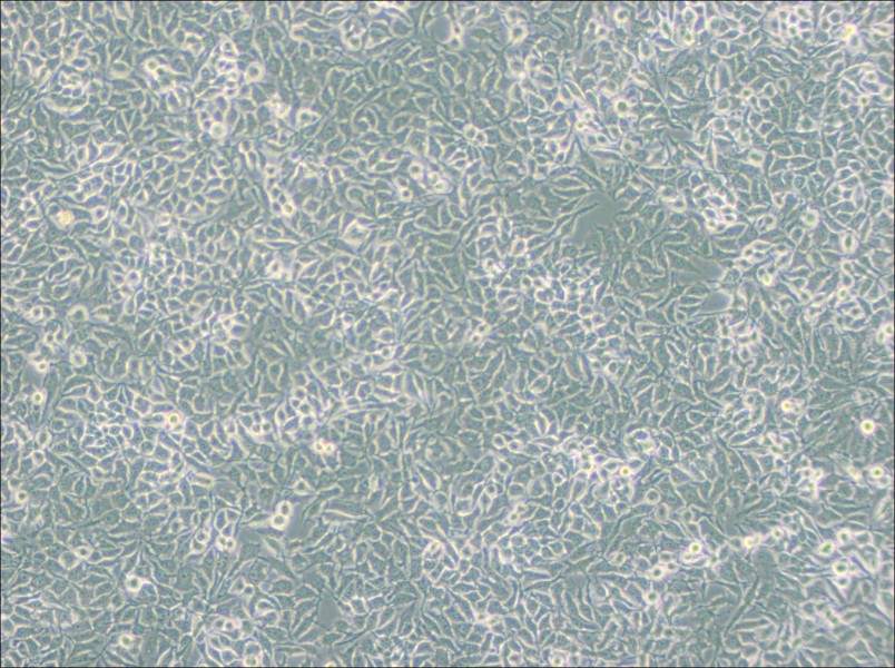 NCI-H3122 Cell Complete Medium-searchlist-1