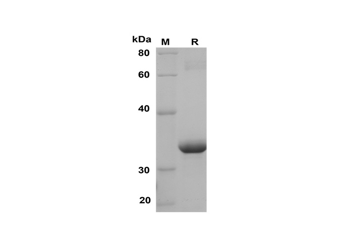 Recombinant Human IL-33 Protein(TRX Tag)-1