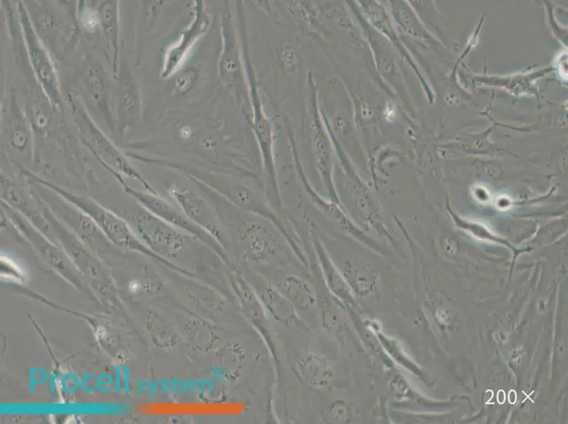 FTC-133 Cell Complete Medium - small - 6