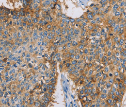 CDCP1 Polyclonal Antibody - 2