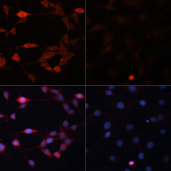 Immunofluorescence analysis of C6 cells using P70 S6K Polyclonal Antibody at dilution of 1:100.C6 cells were treated by Serum-starvation overnight at 37°C. Blue:DAPI for nuclear staining.