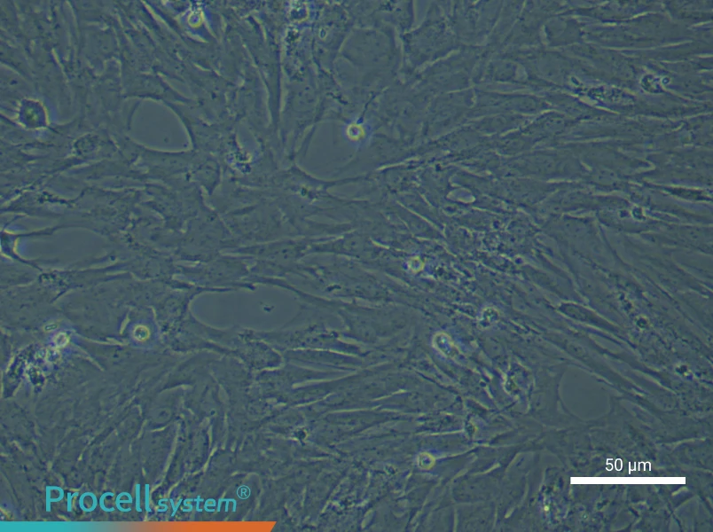 Rat Bladder Fibroblast Complete Medium - 6