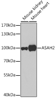 Western blot analysis of extracts of various cell lines using ASAH2 Polyclonal Antibody at 1:500 dilution.