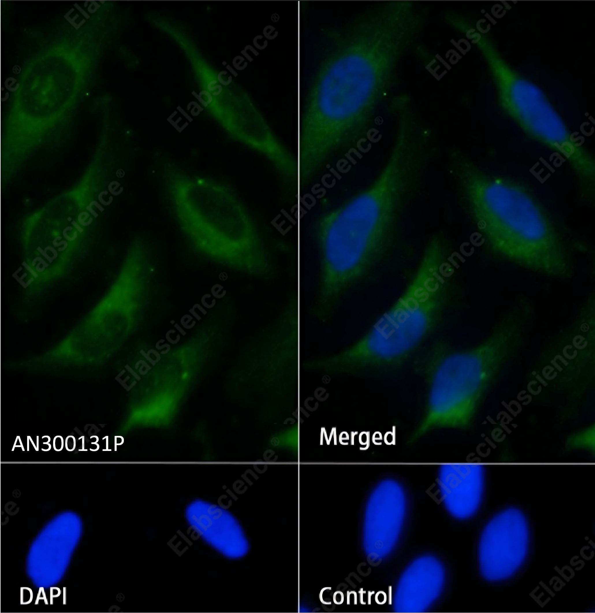 Recombinant S100A12 Monoclonal Antibody - 2