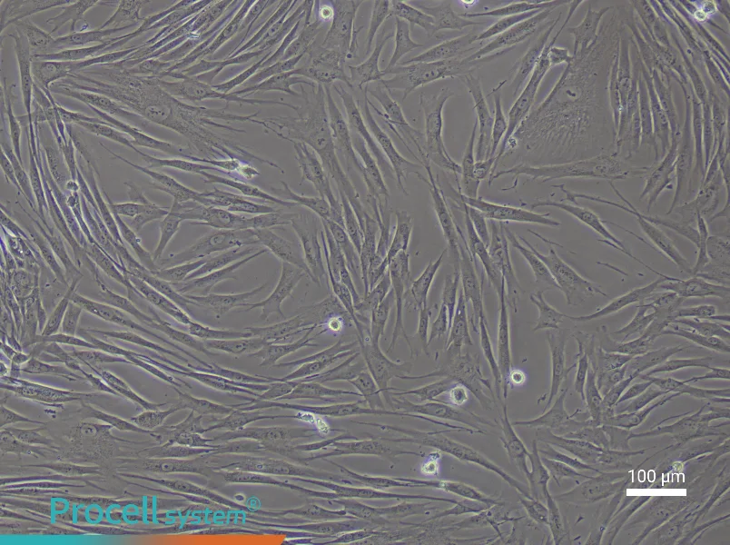 Human Colonic Fibroblast Complete Medium - 3