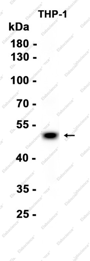 Recombinant IRF8 Monoclonal Antibody - 1
