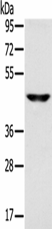 Western Blot analysis of Human fetal brain tissue using SLC16A8 Polyclonal Antibody at dilution of 1:200