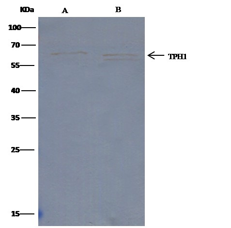 Recombinant Tryptophan Hydroxylase 1/TPH1 Monoclonal Antibody-searchlist-1