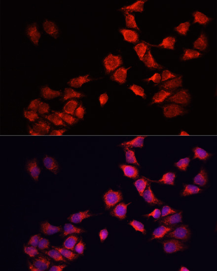 Immunofluorescence analysis of HeLa cells using BNIP3 Polyclonal Antibody at dilution of 1:100. Blue: DAPI for nuclear staining.