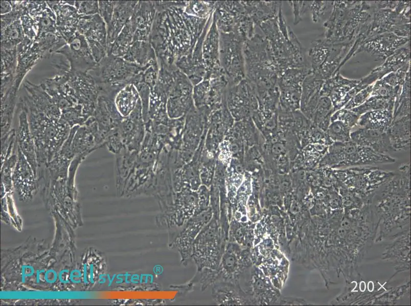 UM-Chor1 Cell Complete Medium - 5