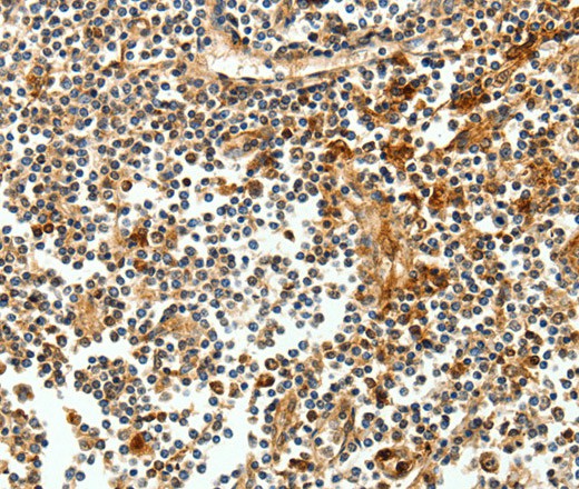 Immunohistochemistry of paraffin-embedded Human tonsil tissue using CEACAM21 Polyclonal Antibody at dilution 1:60