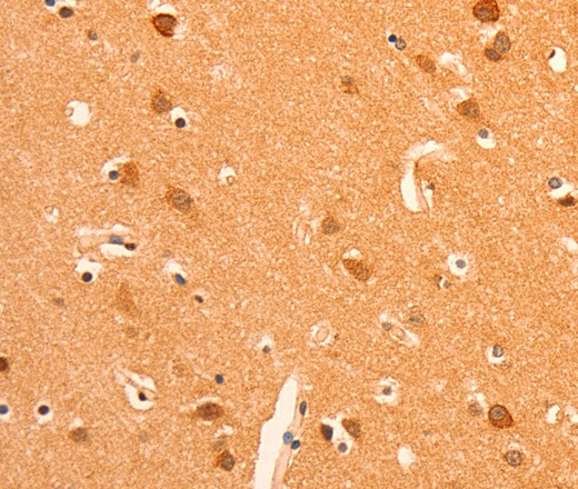 Immunohistochemistry of paraffin-embedded Human brain tissue using GRM3 Polyclonal Antibody at dilution 1:50