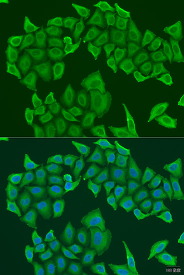 Immunofluorescence analysis of U2OS cells using HAUS8 Polyclonal Antibody at dilution of  1:100. Blue: DAPI for nuclear staining.