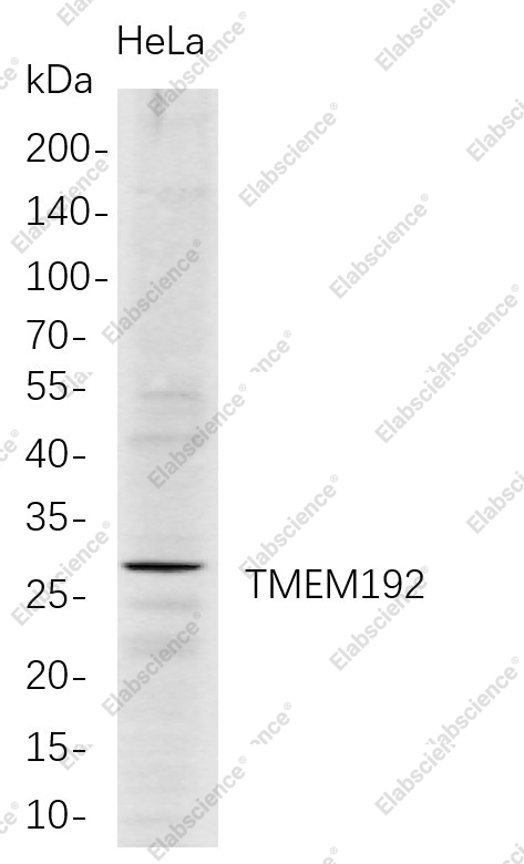 Recombinant TMEM192 Monoclonal Antibody - 1