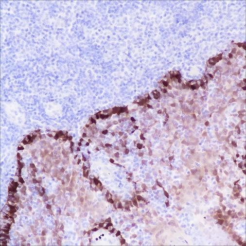 Recombinant ALDH3A1 Monoclonal Antibody - small - 4