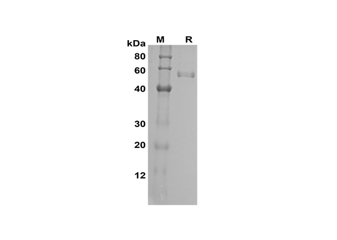 Recombinant Human CCL27/CTACK Protein(Sumo Tag)-产品推荐-1