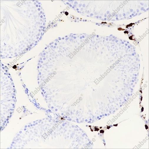 Recombinant Factor XIIIa Monoclonal Antibody - 5
