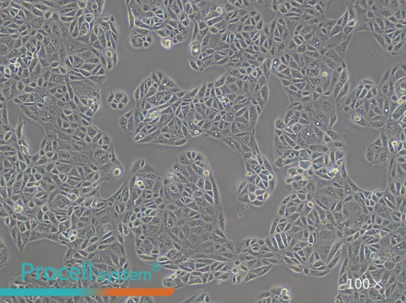 ACHN Cell Complete Medium - 2