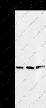 HSD17B8 Polyclonal Antibody - 1