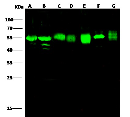 Recombinant ADSL/Adenylosuccinate Lyase Monoclonal Antibody-searchlist-1