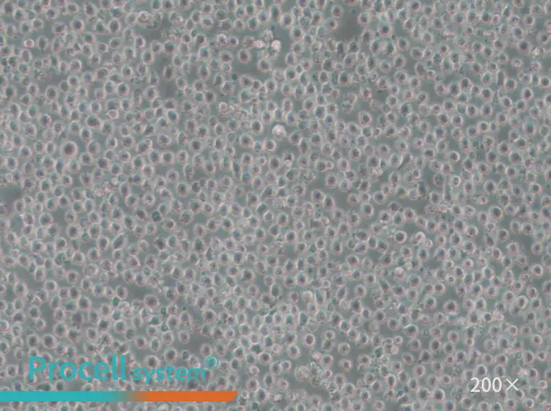 OCI-AML-3 Cell Complete Medium - small - 6