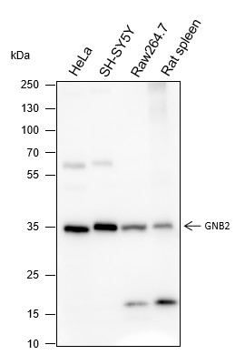 Recombinant GNB2 Monoclonal Antibody-searchlist-1