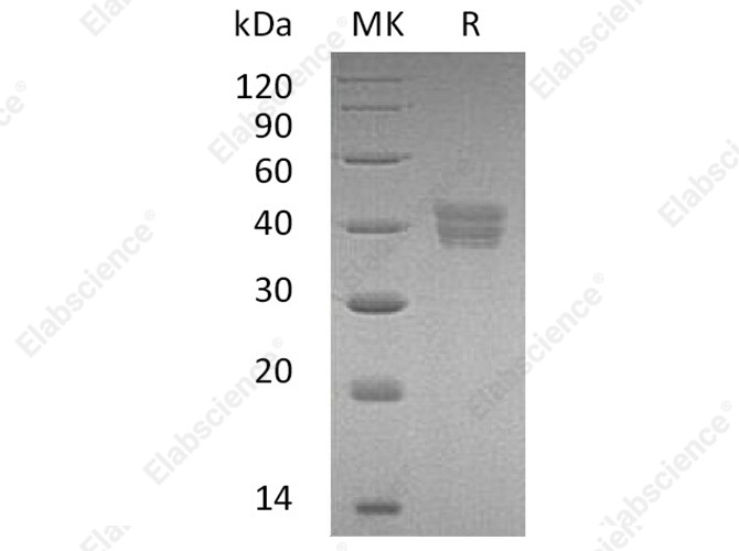 Recombinant Human HtrA2/Omi Protein (His Tag) - 1