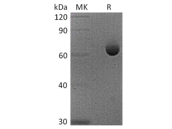 Recombinant Cynomolgus 5'-Nucleotidase/CD73/NT5E Protein (His Tag)
