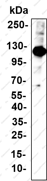 Recombinant TIF1α Monoclonal Antibody - 2