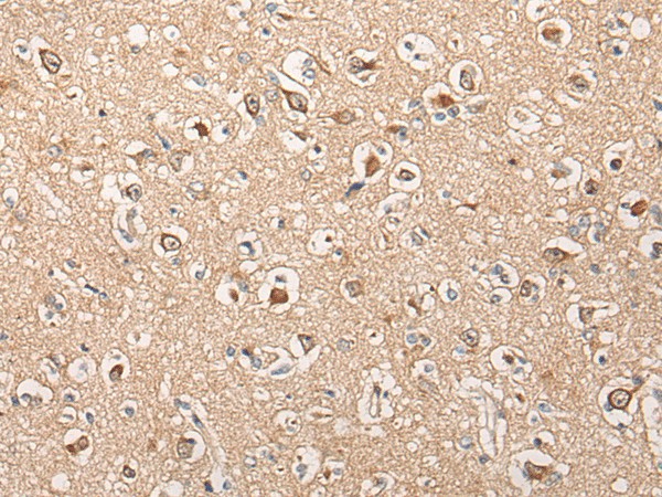 Immunohistochemistry of paraffin-embedded Human brain tissue  using HTRA1  Polyclonal Antibody at dilution of 1:55(?200)