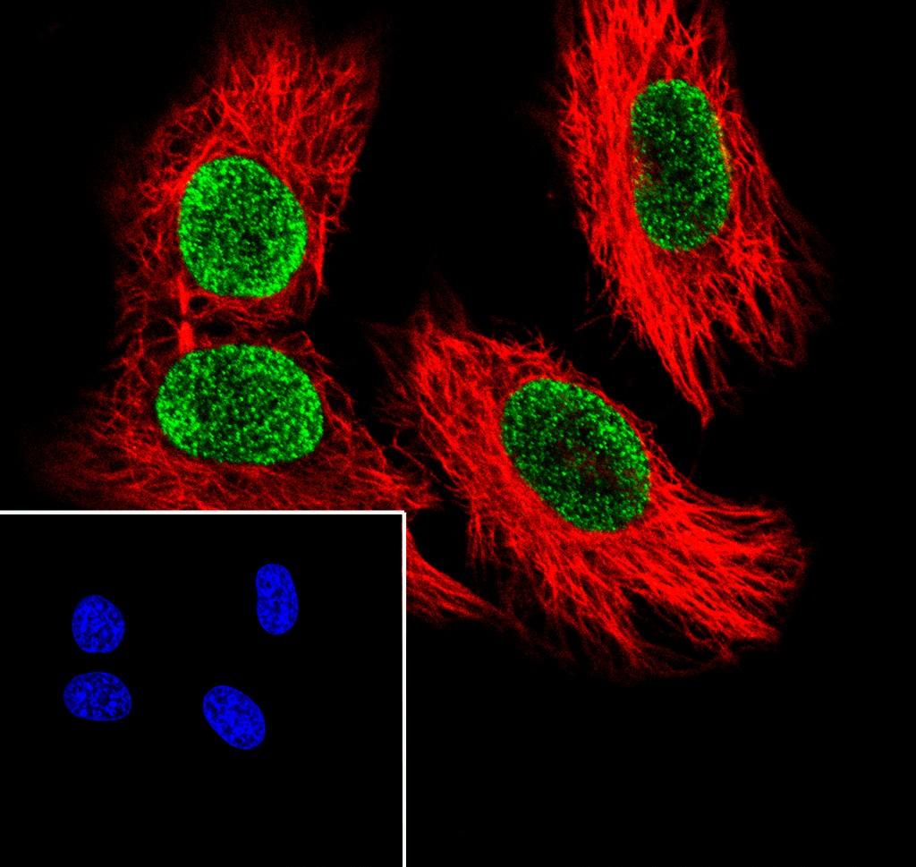 Recombinant Histone H3 (Mono Methyl Arg2) Monoclonal Antibody - small - 3
