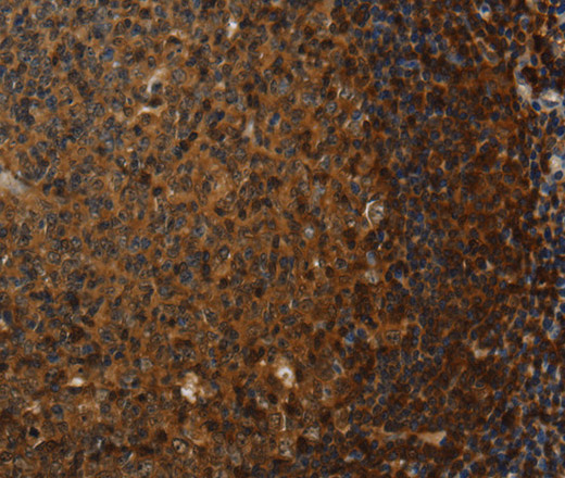 Immunohistochemistry of paraffin-embedded Human tonsil tissue using Claudin 8 Polyclonal Antibody at dilution 1:50