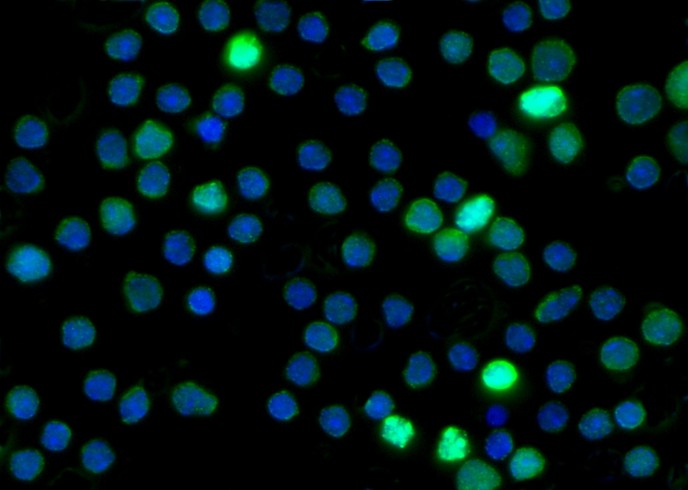 Recombinant RBP4 Monoclonal Antibody - small - 2