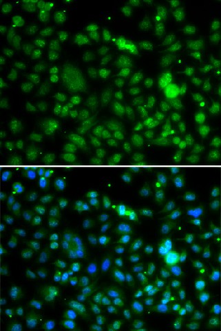 Immunofluorescence analysis of MCF-7 cells using NSUN6 Polyclonal Antibody