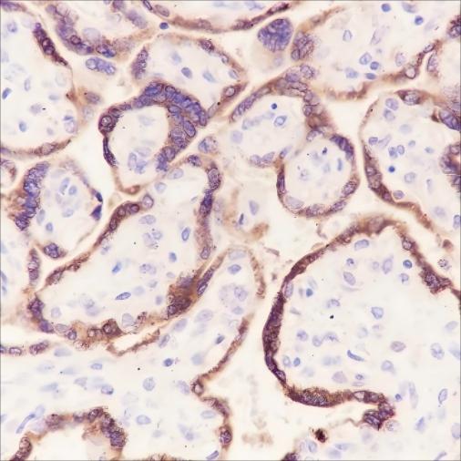 Recombinant CGA/hCG alpha Monoclonal Antibody - 2