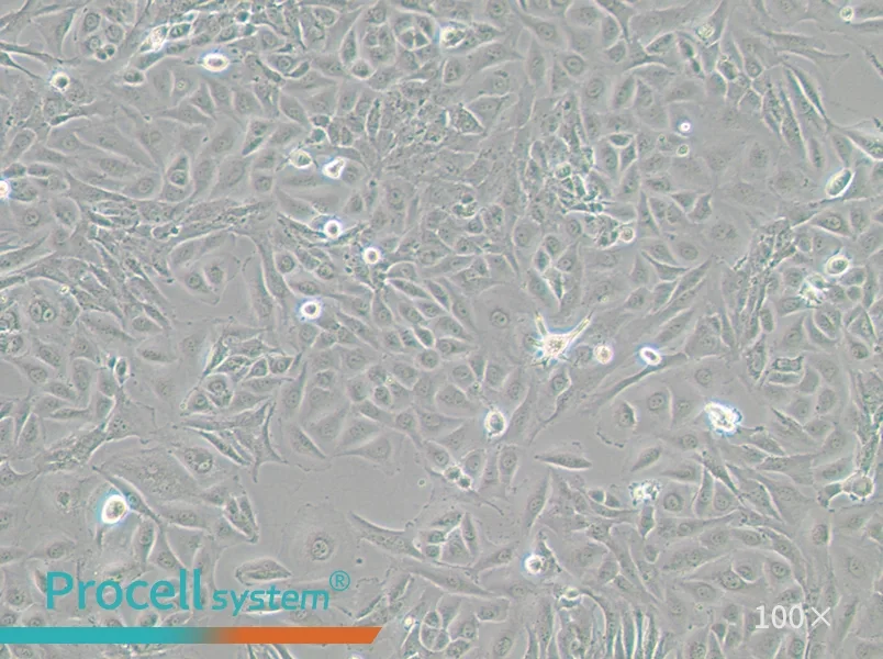 J82 Cell Complete Medium - 3
