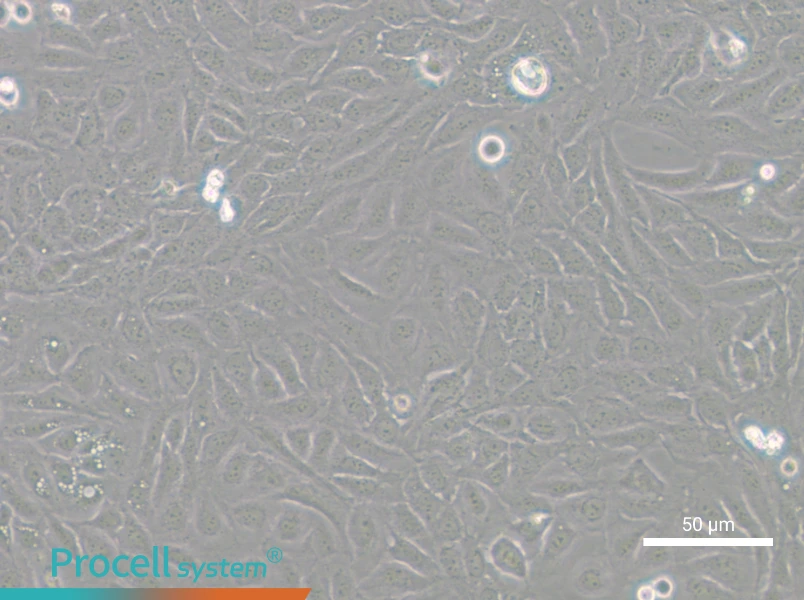 U-2 OS-GFPU-2 OS-GFP - 3