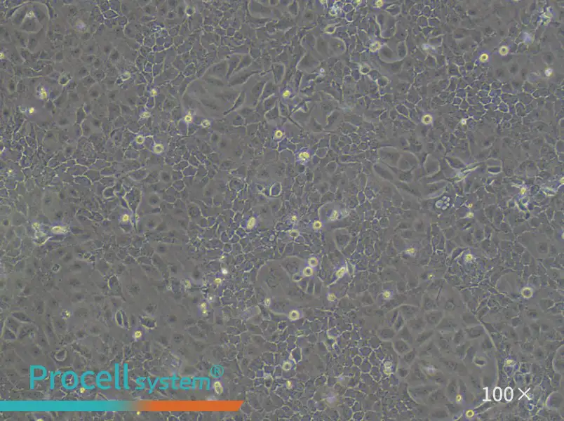 OVCAR-5 Cell Complete MediumOVCAR-5 Cell Complete Medium - 3