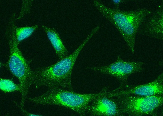 Recombinant TNFR1/CD120a/TNFRSF1A Monoclonal Antibody-searchlist-1