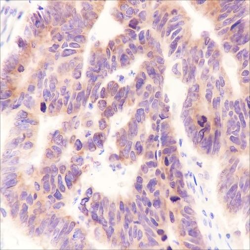 Recombinant MEK2 Monoclonal Antibody - small - 2