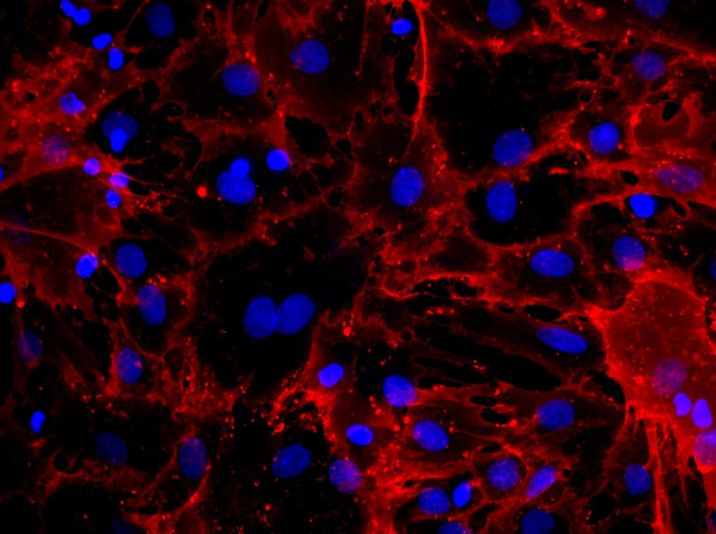 Rat Bone Marrow Mesenchymal Stem Cell Complete MediumRat Bone Marrow Mesenchymal Stem Cell Complete Medium - 2