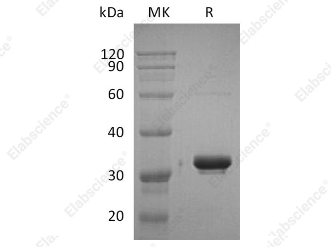 Recombinant Human IgG2-Fc Protein - 1