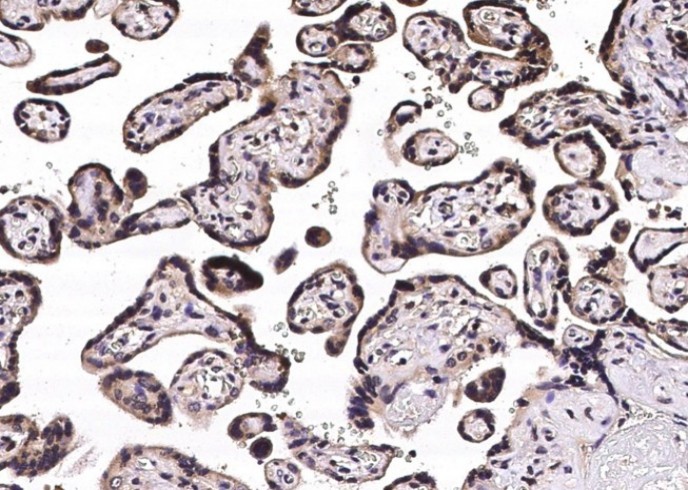 Recombinant STUB1 Monoclonal Antibody - small - 2