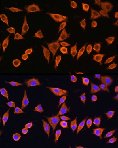 Immunofluorescence analysis of L929 cells using RPS28 Polyclonal Antibody at dilution of 1:100. Blue: DAPI for nuclear staining.