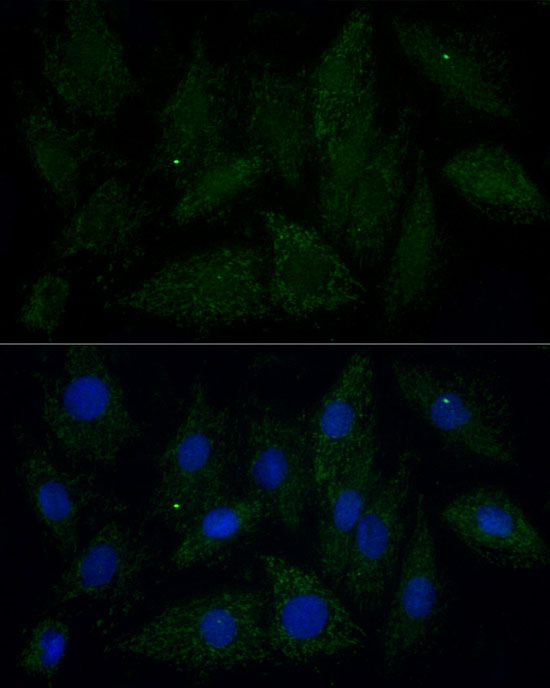 Immunofluorescence analysis of H9C2 cells using ATAD3A/ATAD3B Polyclonal Antibody at dilution of 1:100 (40x lens).Blue: DAPI for nuclear staining.